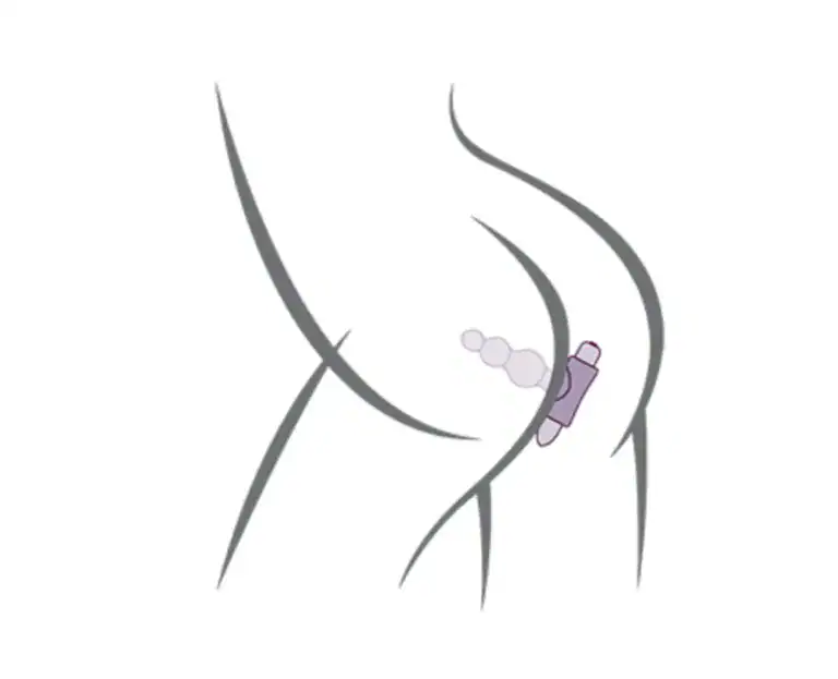 plug anal vibratii4
